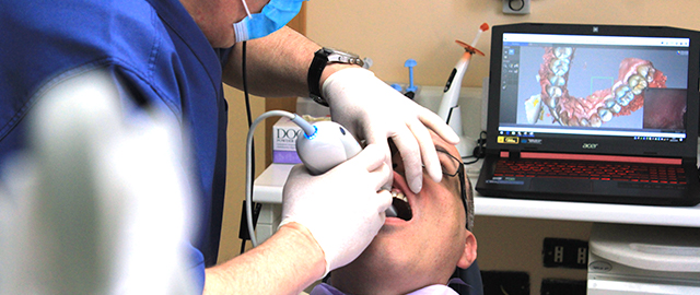 Escaneamento Intraoral